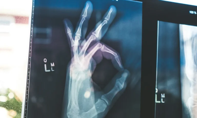 Entenda a função endócrina dos ossos e a osteoporose